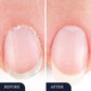 💅 BUY 2 GET 1 FREE! ✨ Toenail Fungus Treatment Pen – Fast-Acting Formula, Precise Application & Soothing Relief 🦶