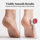 🎉 2026 Sale — Over 16,000 Sold! 👣 Double-Sided Foot Scraper – Removes Tough Calluses, Reveals Smooth Skin – Salon Pedicure at Home! ✨
