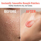 🌹 50% OFF NOW! 🧴 Exfoliating & Moisturizing Body Polish – Rose Sugar Scrub, Shea Butter & Gentle on Skin ✨