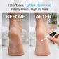 🎉 2026 Sale — Over 18,000 Sold! 💅 Tired of rough heels and expensive salon trips? This electric nail drill removes calluses fast, comes with interchangeable heads, and shows battery life on a smart LED screen — professional results, zero salon wait. ✨
