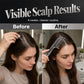 🎉 2026 Sale — Over 14,000 Sold! 💆‍♀️ Scalp Applicator Comb – No More Messy Drops, No More Wasted Product – Even Coverage, Every Time ✨