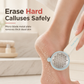 🦶 LIMITED-TIME 50% OFF ✨ 3-in-1 Foot Callus Remover — Stainless Steel File, Toe Scrub & Pumice