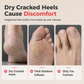 🦶 LIMITED-TIME 50% OFF ✨ 3-in-1 Foot Callus Remover — Stainless Steel File, Toe Scrub & Pumice
